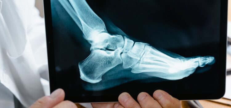 A doctor reviews a foot X-ray on a digital tablet in a medical consultation setting.